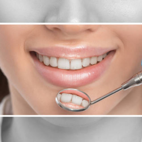Angelin Dental Clinic